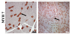MYH7 Antibody - Figure 2.