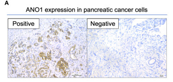 ANO1 Antibody - Figure 1.