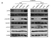 Ras-GRF1 Antibody - Figure 3 The role and mechanism of THBS1 in osteosarcoma cell dedifferentiation and tumor malignancy.