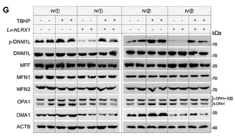 OMA1 Antibody - Figure 4.