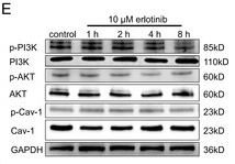 Phospho-AKT1 (Ser124) Antibody - Figure 5: Cav-1 inhibits migration and proliferation of BMECs through suppressing EGFR/AKT/PI3K signaling.