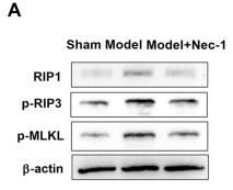 Phospho-MLKL (Ser358) Antibody - Figure 2 .