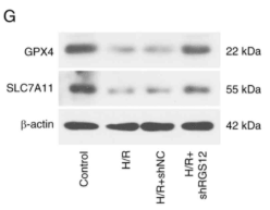 xCT Antibody - Figure 3 - RGS12 silencing inhibits ferroptosis in H/R cells.