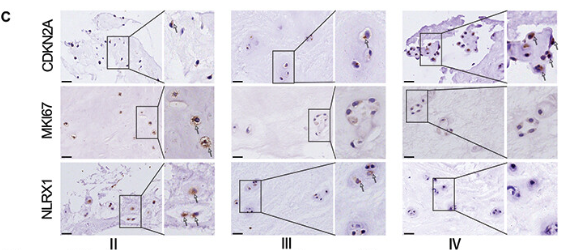 Ki67 Antibody - Figure 1.