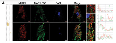 LC3B Antibody - Figure 3.