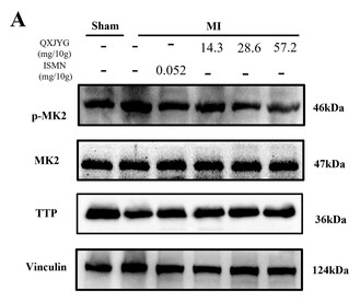 Phospho-MAPKAPK2 (Thr221/Thr222) Antibody - Figure 4.