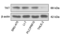 Transketolase Antibody - Fig.