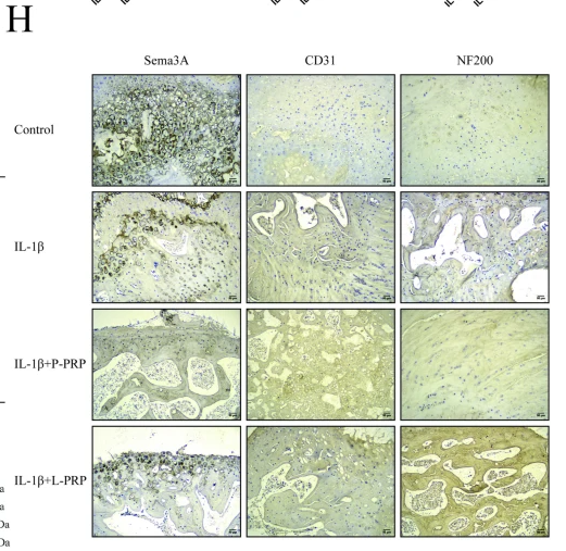 SEMA3A Antibody - Fig.