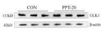 ULK1 Antibody - Fig.