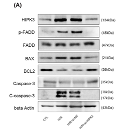 Phospho-FADD (Ser194) Antibody - Figure 6 (A) Representative images of Western blot analysis.