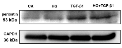POSTN Antibody - Figure 2 Western blot analysis of periostin protein expression in HK-2 cells stimulated by HG (22 mmol/L) and high concentration of TGF-β1 (10 ng/mL); Image J software was used to collect the gray value of protein bands.