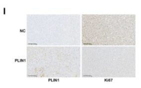 Ki67 Antibody - Fig.