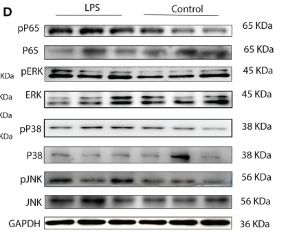 JNK1/2/3 Antibody - Figure 4 Expression of TLR4, and MAPK/NK-κB activation as well as expression of UAPs (OTR, CX43) in myomentrium of LPS induced preterm labor and PBS treated control group.