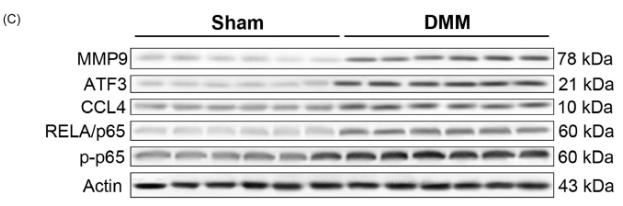Phospho-NF-kB p65 (Ser536) Antibody - Figure 11 Four hub genes (matrix metalloproteinase [MMP] 9, ATF3, CCL4, RELA) were upregulated in destabilization of the medial meniscus (DMM) mouse model.