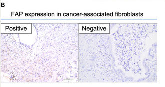 FAP Antibody - Figure 1.