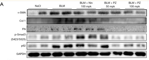 Collagen I Antibody - Figure 6.