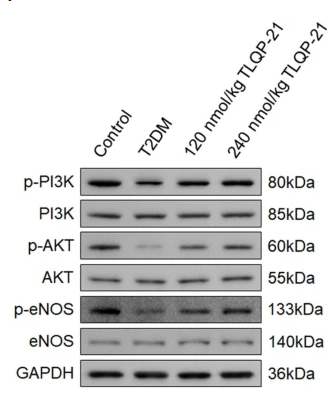 Phospho-eNOS (Ser1177) Antibody - Fig.