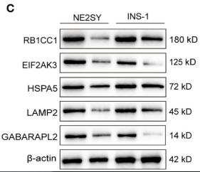 GABARAPL2 Antibody - Figure 7 RT-qPCR and Western blot validation of the DEARGs in STZ-treated islet cells.