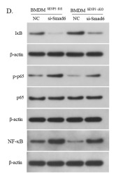 Phospho-NF-kB p65 (Ser536) Antibody - Fig.