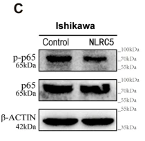 Phospho-NF-kB p65 (Ser536) Antibody - Figure 4 NLRC5 suppresses the NF-κB pathway in vivo and in vitro.