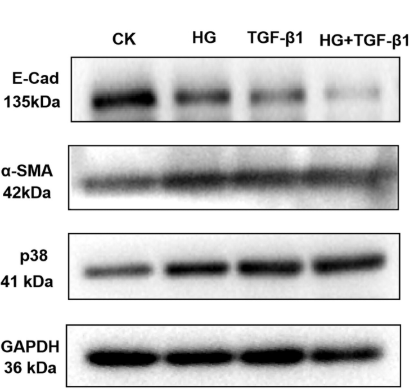 alpha-SMA Antibody - Figure 4 Western blot was used to detect the expression of E-Cad, α-SMA and p38 in HK-2 cells induced by HG (22 mmol/L), TGF-β1 (10 ng/mL) and HG + TGF-β1 (22 mmol/L, 10 ng/mL).