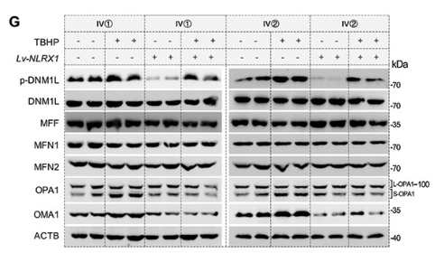 Phospho-DRP1 (Ser637) Antibody - Figure 4.