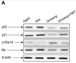 p21 Cip1 Antibody - Figure 3.