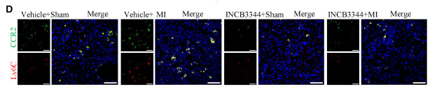 CCR2 Antibody - Figure 3 Depleting Ly6Chi monocytes alleviates liver damage caused by MI in CDAHFD-fed mice (A) Experiment 4: CCR2 inhibitor INCB3344 experiment.
