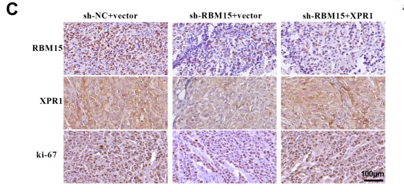 RBM15 Antibody - Fig.
