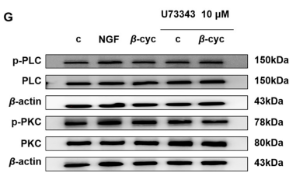 Phospho-PLC beta 3 (Ser537) Antibody - Figure 5.
