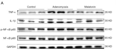 IL1 beta Antibody - Figure 6.
