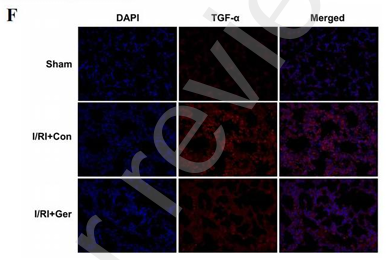 TGF alpha Antibody - Figure2 Germacrone attenuated the release of inflammatory factors and inhibits apoptosis.