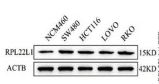 RPL22/L1 Antibody - Figure 2: Knockdown of RPL22L1 and detection of its biological function.