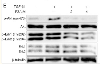 Phospho-AKT1/2/3 (Ser473) Antibody - Figure 5.