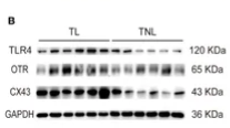 Connexin 43 / GJA1 Mouse Monoclonal Antibody - Figure 7 Characterization of TLR4, and MAPK/NK-κB activation as well as expression of UAPs (OTR, CX43) in myomentrium of pregnant women before and after the onset of labor at term.