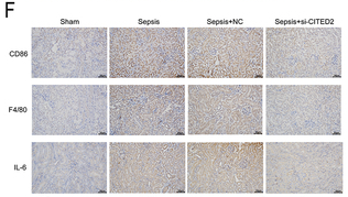 IL6 Antibody - Figure 2 CITED2 Regulation of kidney inflammation in S-AKI mice models.