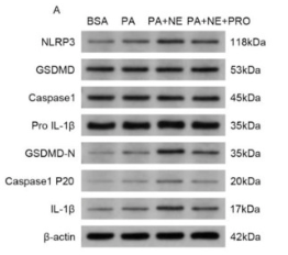 GSDMD Antibody - Fig.