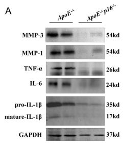 IL6 Antibody - FIGURE 2 p16 knockout (p16−/−) mice ameliorate high-fat diet (HFD)-induced renal inflammation of ApoE−/− mice.