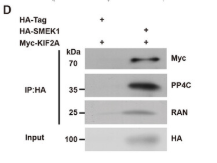 PPP4C Antibody - Figure 6 Smek1 interacts with kinesin family member 2A (Kif2a), while Smek1 deficiency caused cytoplasmic Kif2a aggregation.