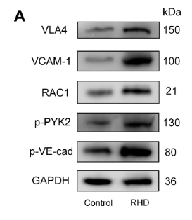 Phospho-VE-Cadherin (Tyr731) Antibody - Fig.
