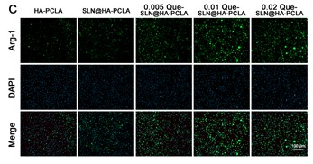 ARG1 Antibody - Figure 5.