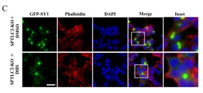 Synphilin-1 Antibody - Figure 7 Sphingolipids regulate SY1-induced cytotoxicity and SY1 IB morphology in mammalian cells.