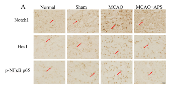 Phospho-NF-kB p65 (Ser536) Antibody - Fig.