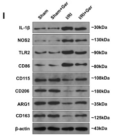 CD163 Antibody - Figure 2 .