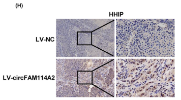 Hhip Antibody - FIGURE 6 CircFAM114A2 suppresses HCC progression through miR-630/HHIP axis.