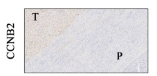 CCNB2 Antibody - Fig.
