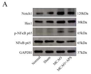 NF-kB p65 Antibody - Fig.