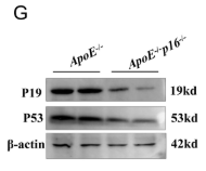 p53 Antibody - FIGURE 1 p16 knockout (p16−/−) mice ameliorate high-fat diet-induced renal fibrosis.