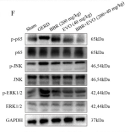 NF-kB p65 Antibody - Fig.