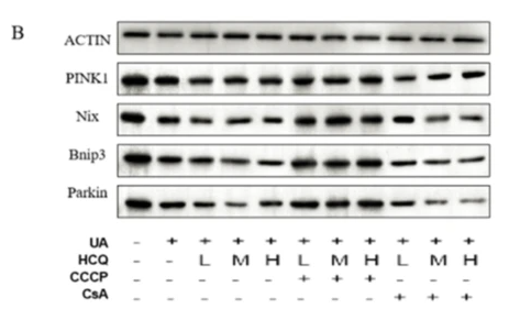 Parkin Antibody - Fig.